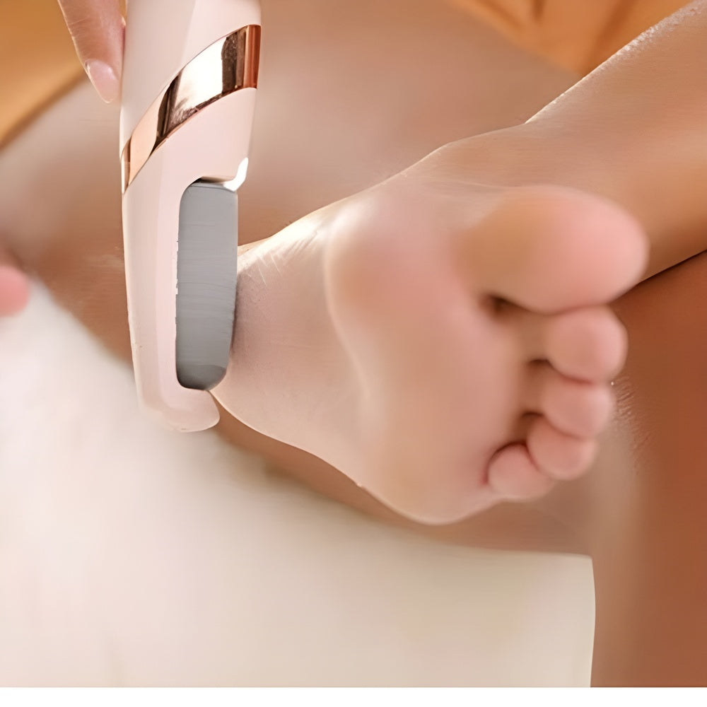 PedicuPro™ | Pedi Roller